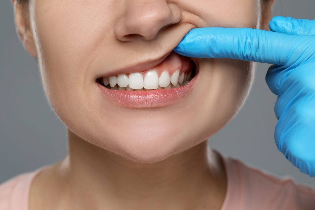 periodontal care