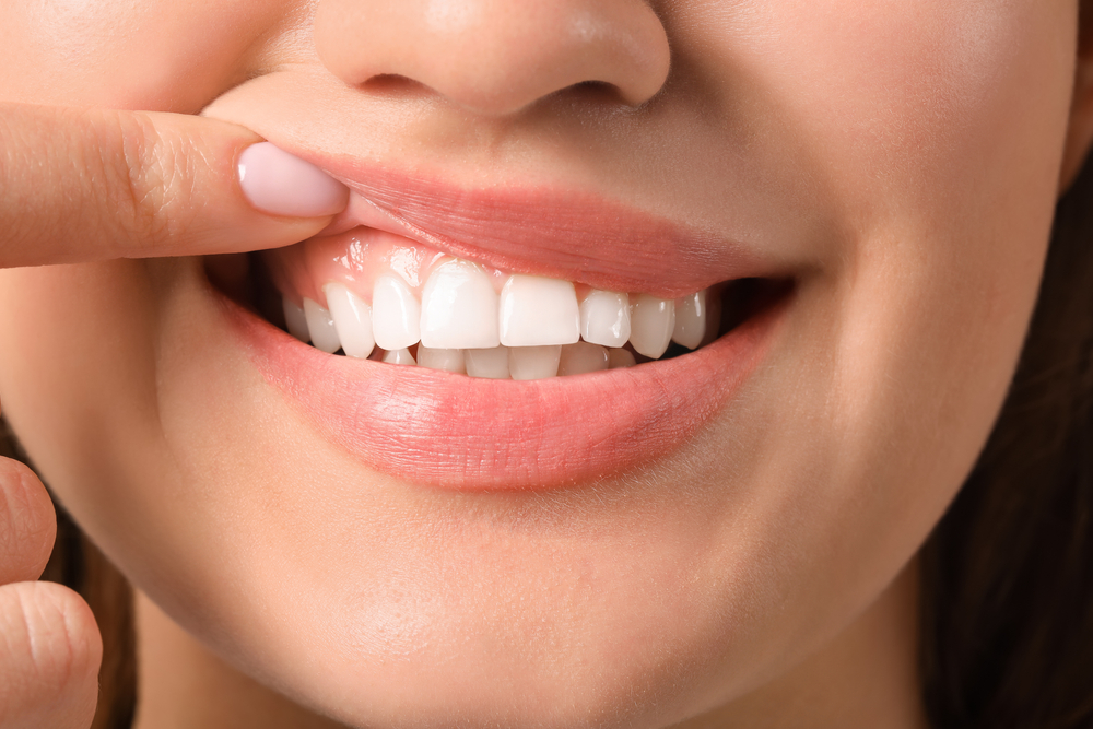 healthy gums for national gum care month